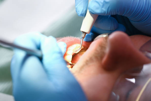 Best Emergency Dental Services for Seniors in Shady Spring, WV